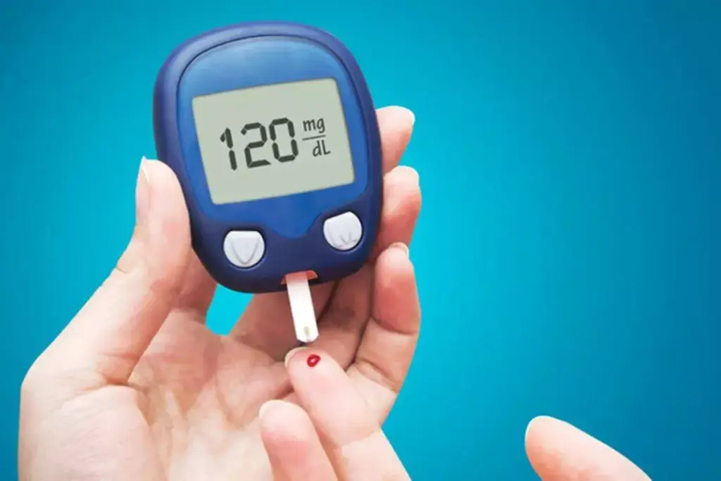 Random Blood Sugar