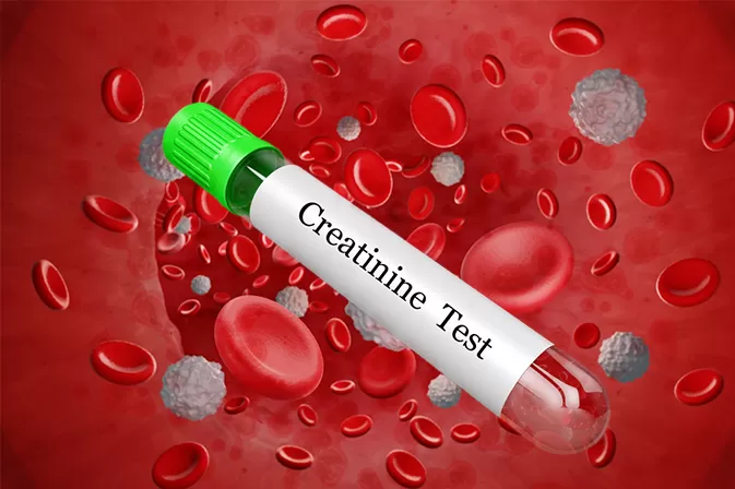 Serum Creatinine
