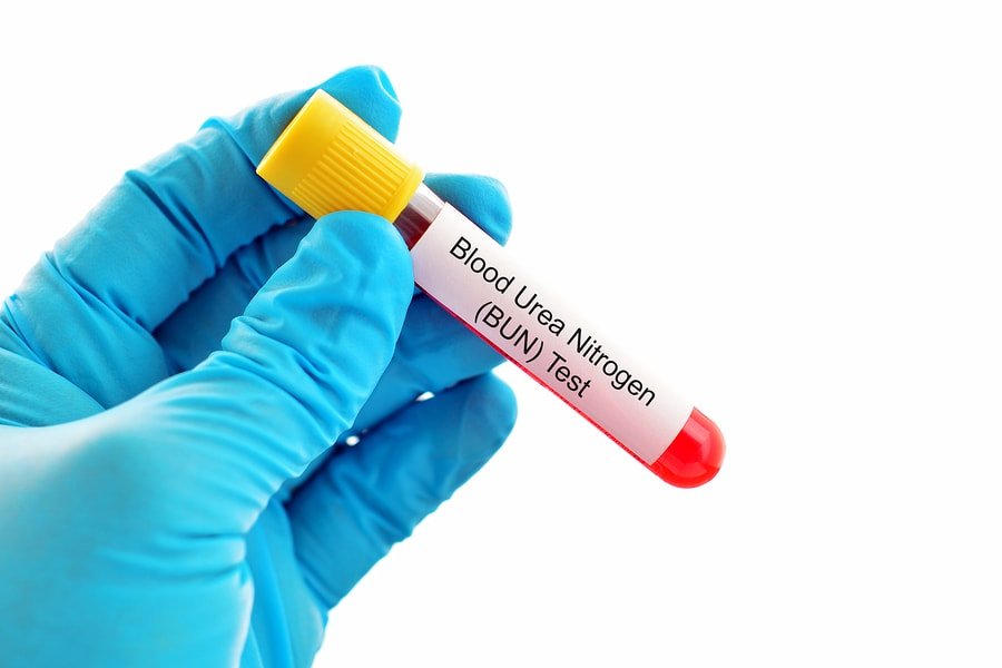 Blood Urea
