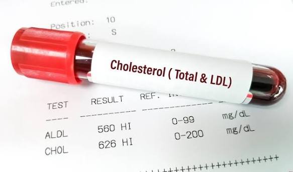 Serum Total Cholesterol
